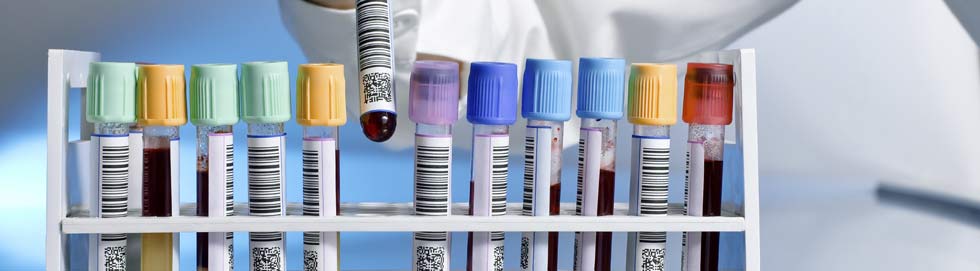 Punkt pobrań materiałów laboratoryjnych