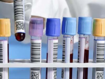 Punkt pobrań materiałów laboratoryjnych