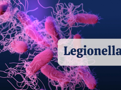 Legionella
