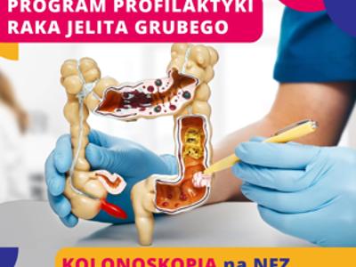 Zdjęcie grafiki dotycząj badania kolonoskopi