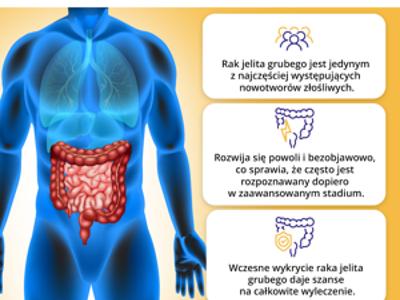 Zdjęcie grafiki dotycząj badania kolonoskopi