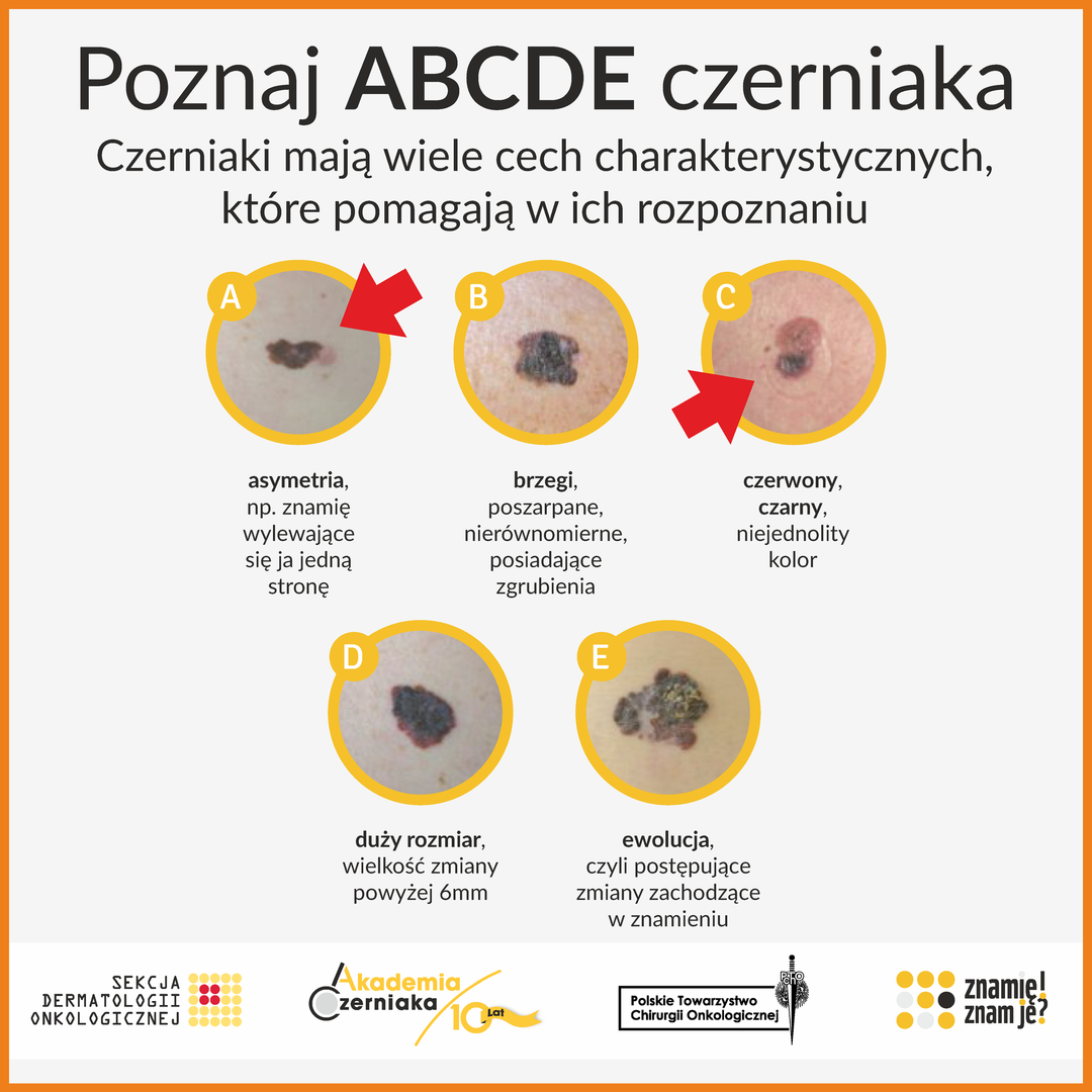 Grafika czerniaka
