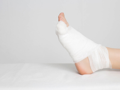 Zdjęcie dot. odmrożenia