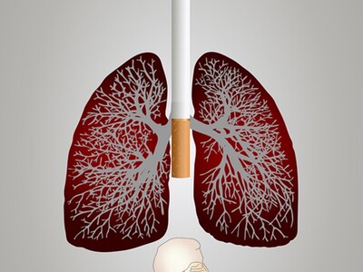 Zdjęcie dot, walki z rakiem